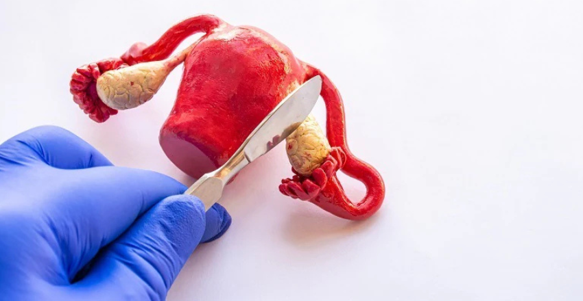 Doctor performing hysterectomy