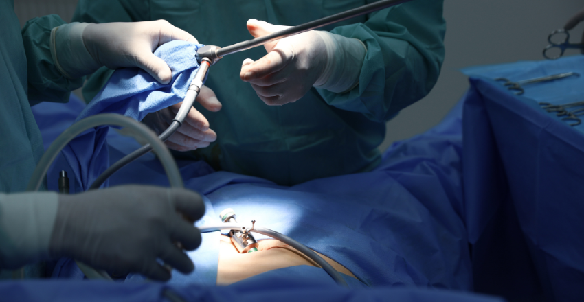 Laparoscopy procedure